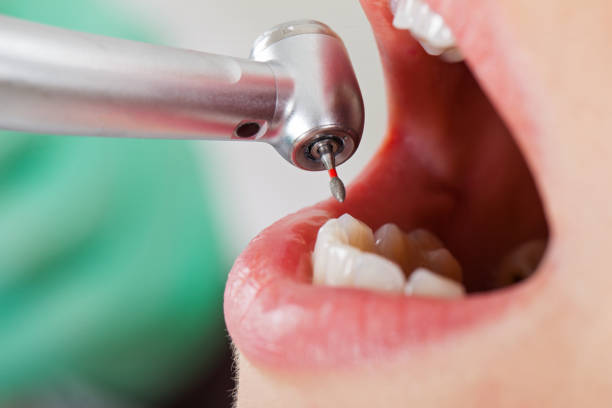 Best Emergency Dental Care for Broken or Chipped Teeth in Dumas, AR